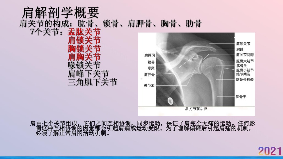 浅谈偏瘫并发症肩痛治疗课件.pptx_第3页