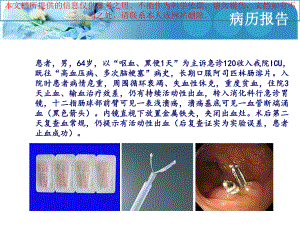 消化道出血医患沟通培训课件.ppt