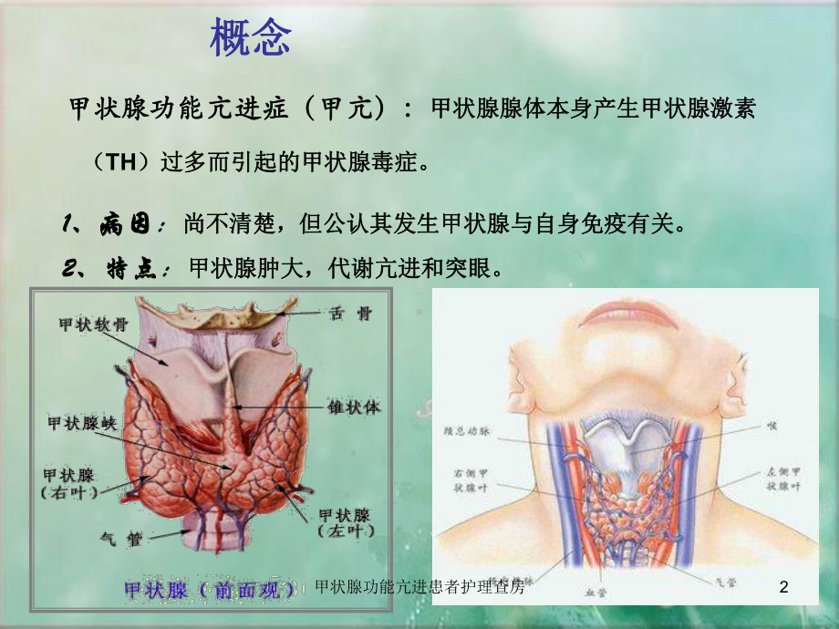 甲状腺功能亢进患者护理查房培训课件.ppt_第2页