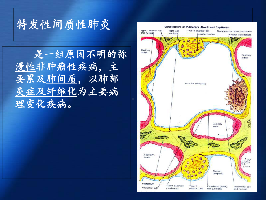 特发性间质性肺炎病理特征及分类课件.ppt_第2页