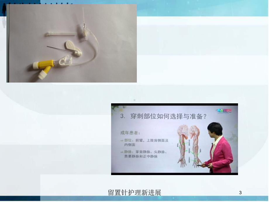 留置针护理新进展培训课件.ppt_第3页