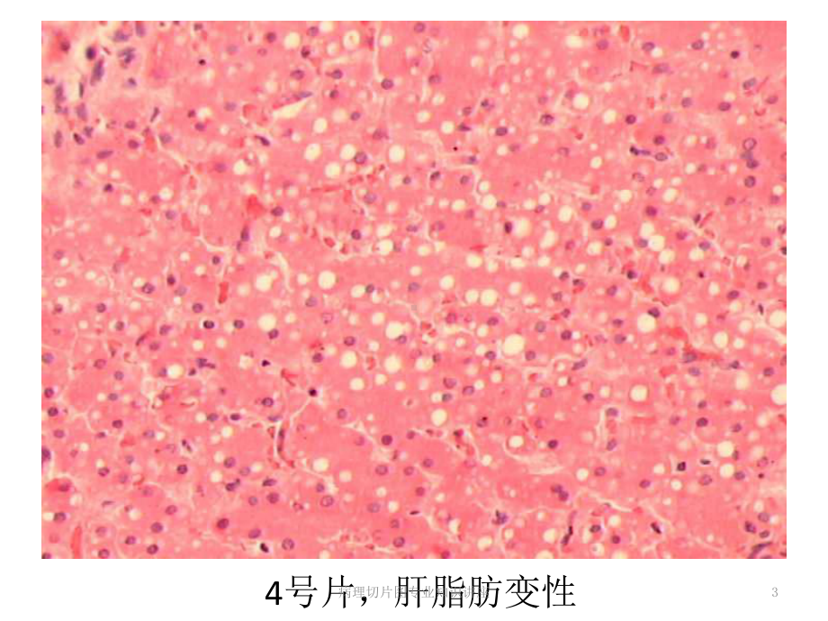 病理切片图专业知识讲座培训课件.ppt_第3页