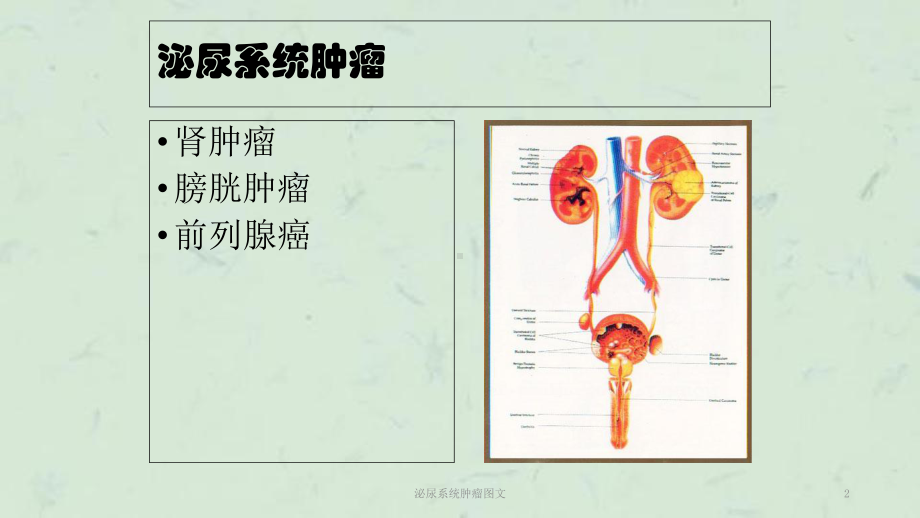 泌尿系统肿瘤课件-3.ppt_第2页