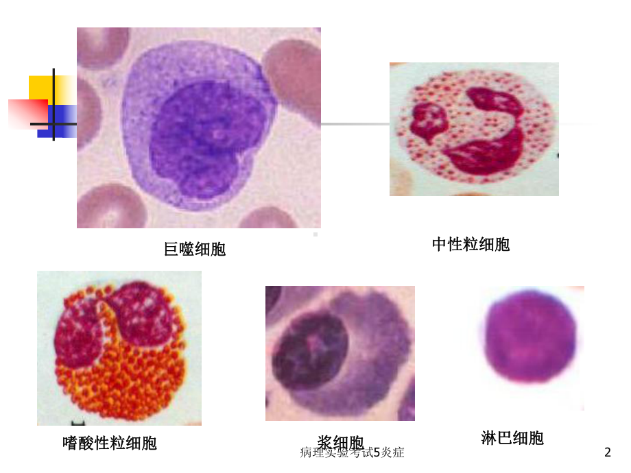 病理实验考试5炎症课件.ppt_第2页