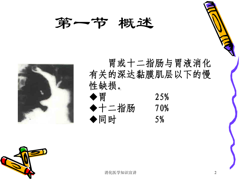 消化医学知识宣讲培训课件.ppt_第2页