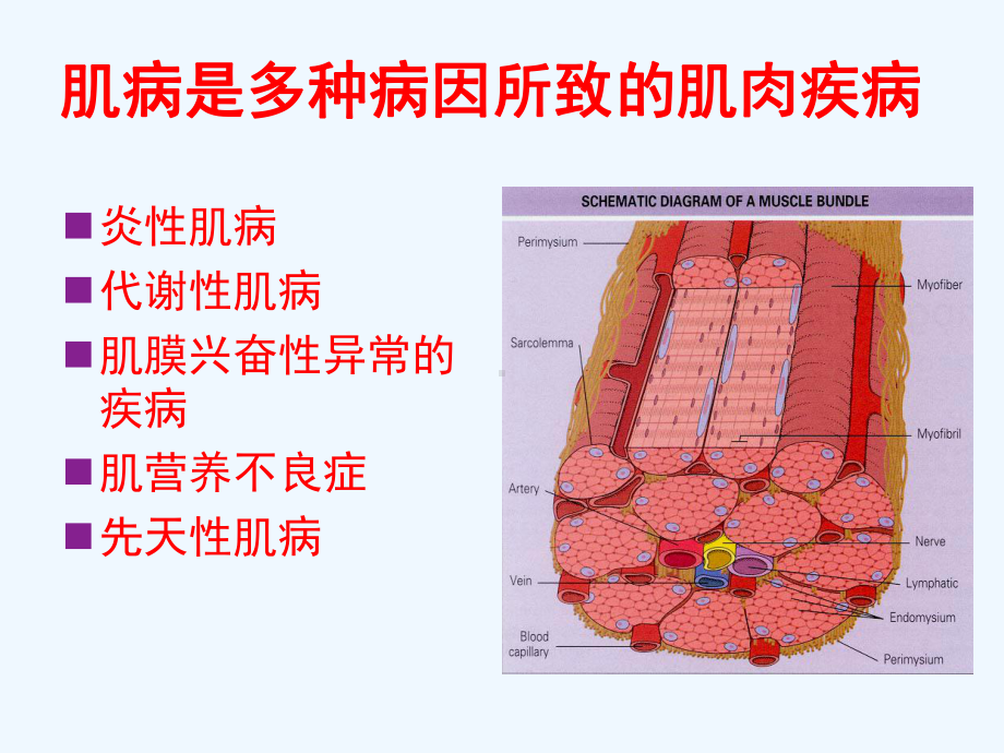 特发性炎症性肌病课件.ppt_第3页