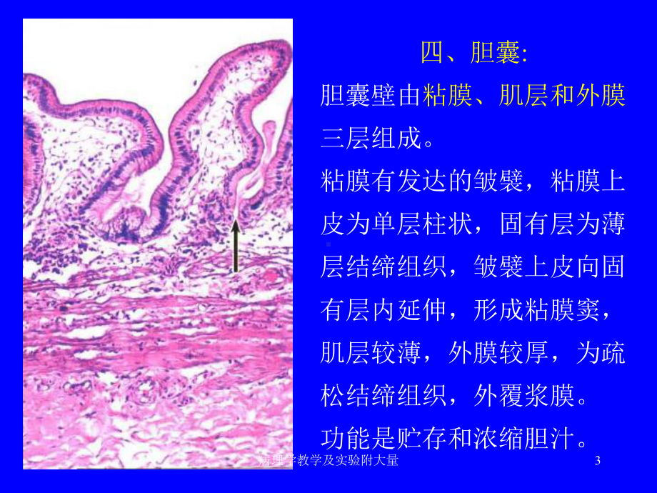 病理学教学及实验附大量课件.ppt_第3页