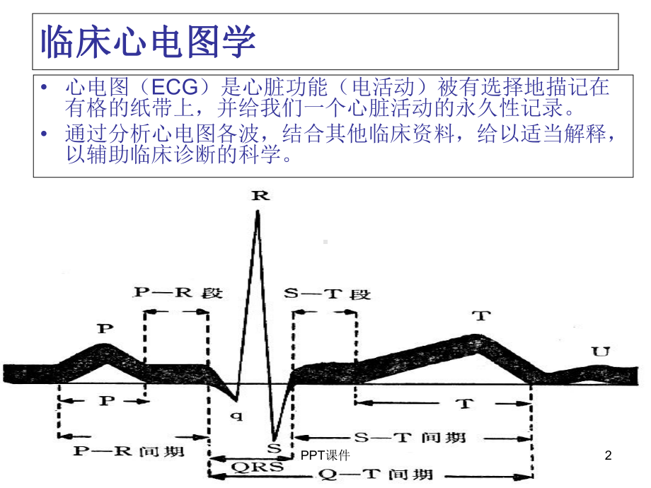 正常及异常心电图-课件.ppt_第2页