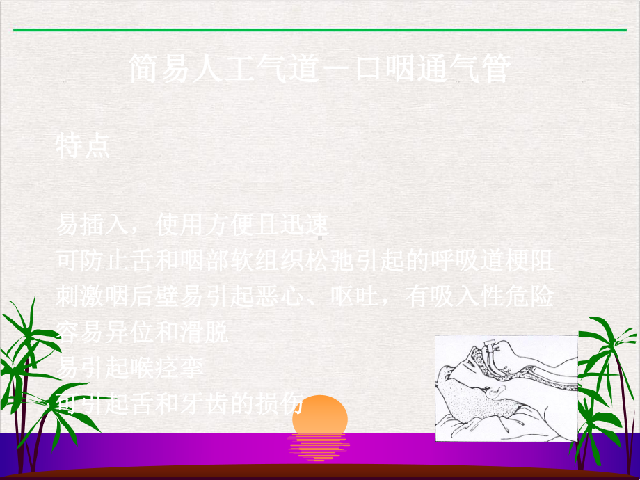 气管切开护理月日课件精美版.pptx_第2页