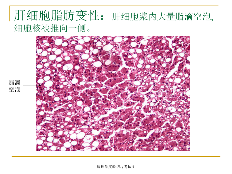 病理学实验切片考试图-课件.ppt_第3页