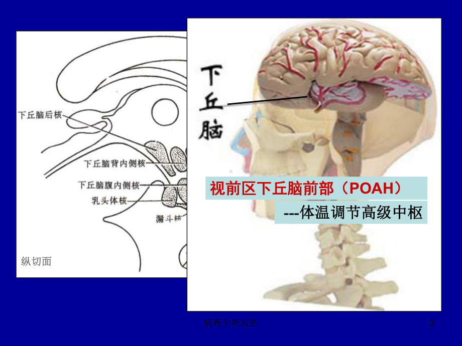 病理生理发热课件.ppt_第3页