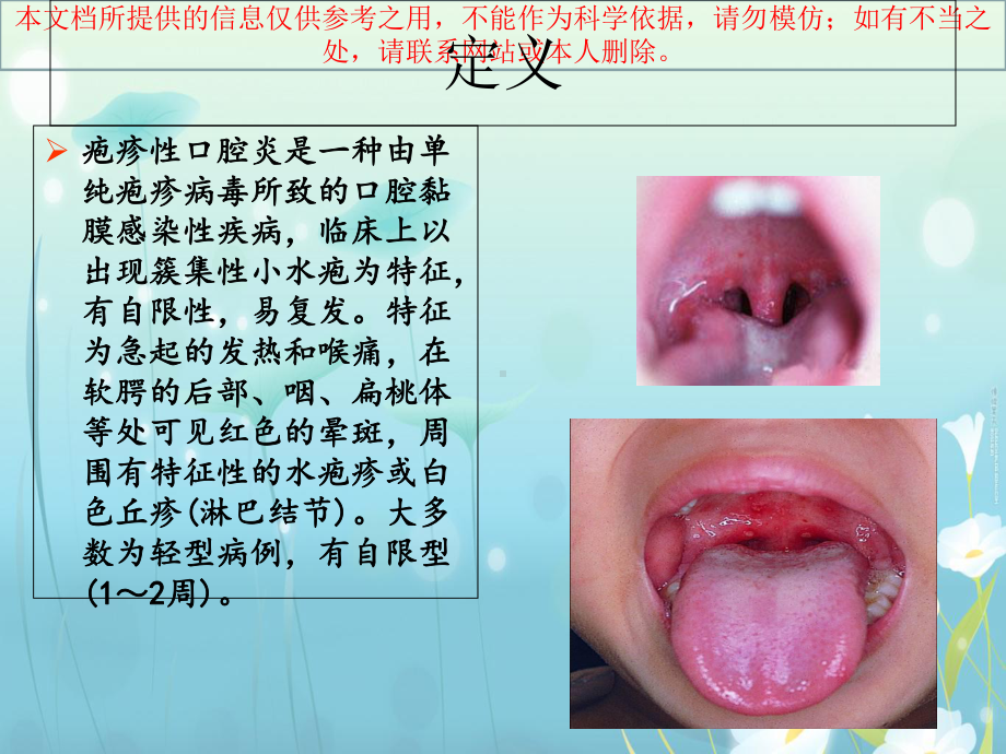 疱疹性咽峡炎培训课件.ppt_第1页