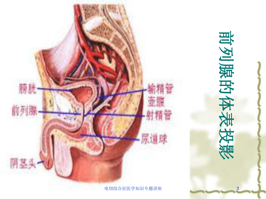 电切综合征医学知识专题讲座培训课件.ppt_第3页