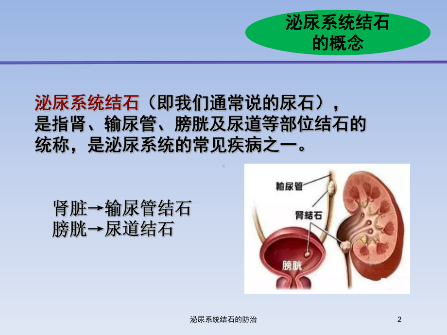 泌尿系统结石的防治培训课件.ppt_第2页