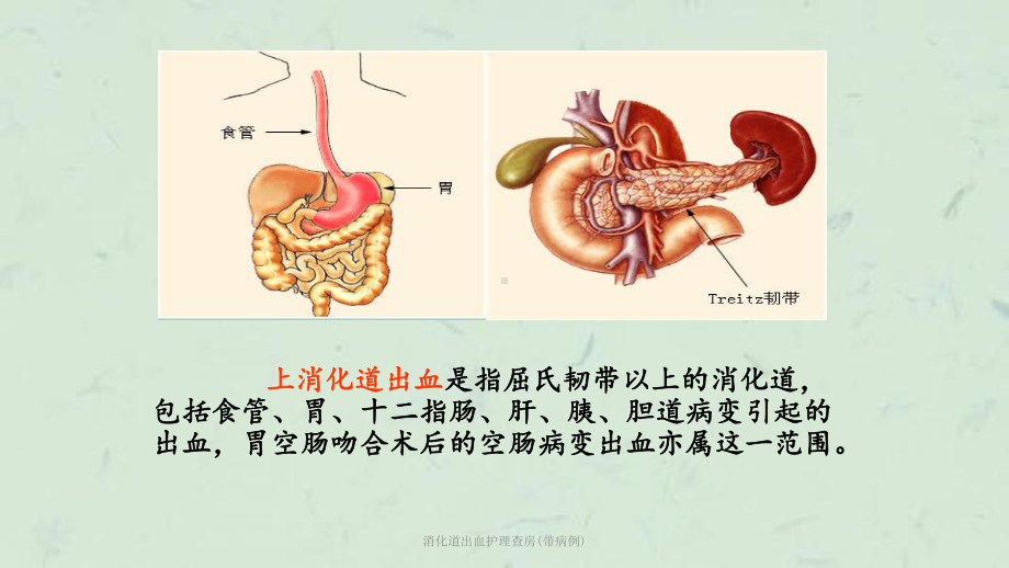 消化道出血护理查房(带病例)课件.ppt_第2页