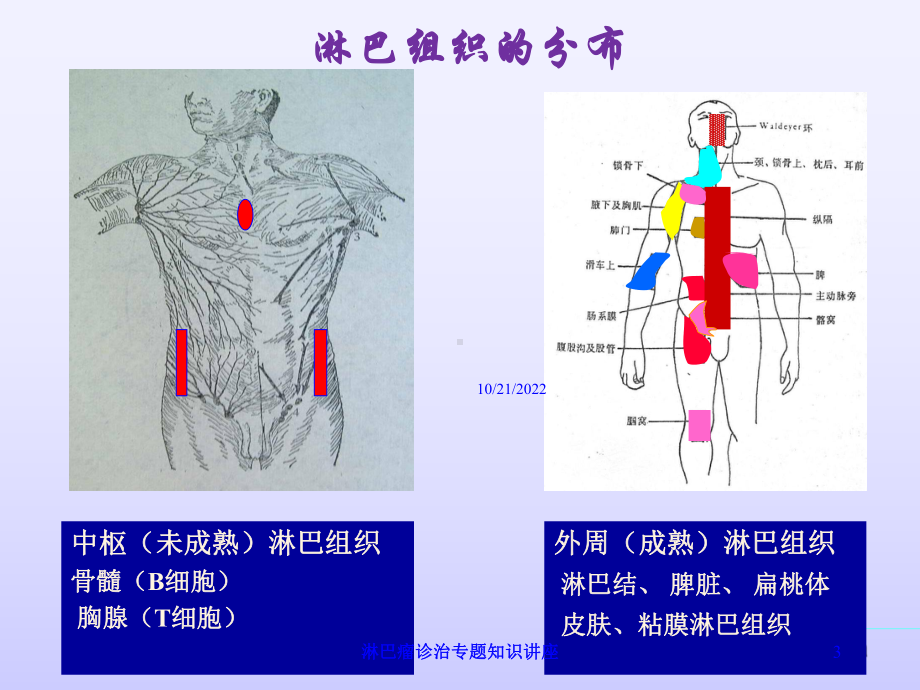 淋巴瘤诊治专题知识讲座培训课件.ppt_第3页