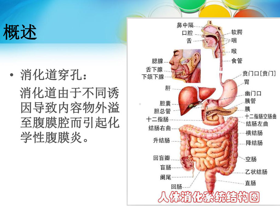 消化道穿孔护理查房主题讲座课件.ppt_第2页