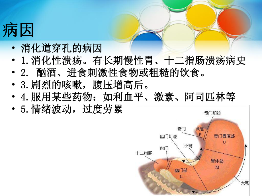 消化道穿孔护理查房主题讲座课件.ppt_第3页