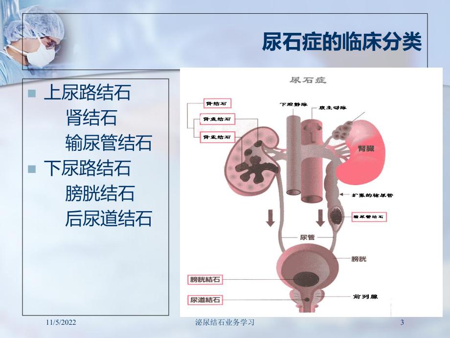 泌尿结石业务学习培训课件.ppt_第3页