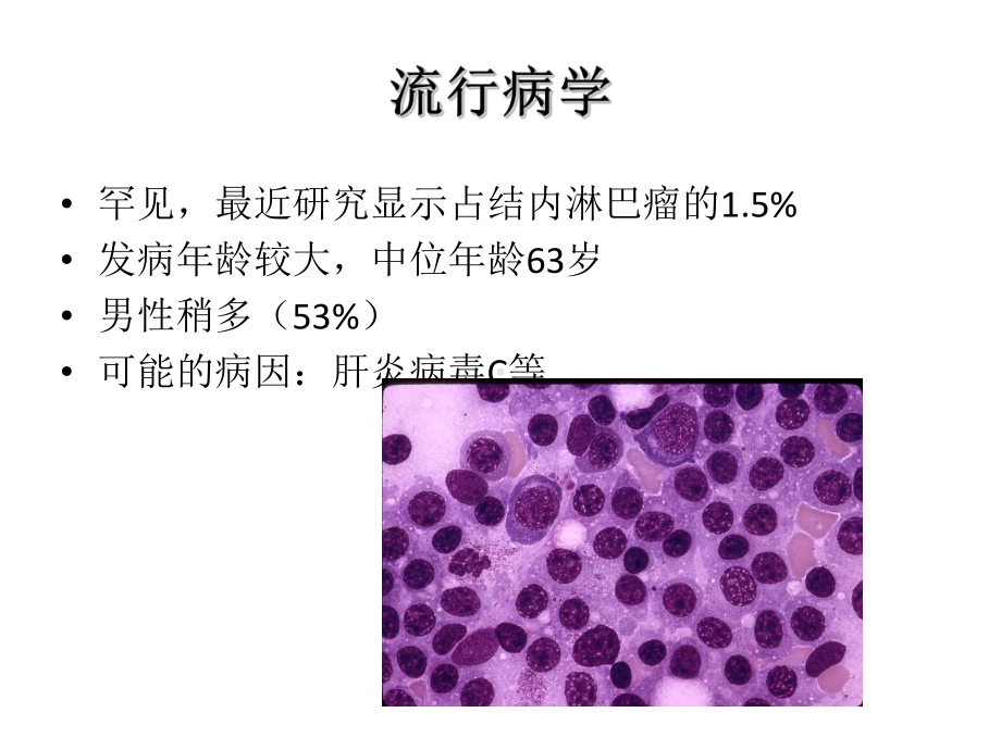 淋巴浆细胞淋巴瘤培训课件.ppt_第3页