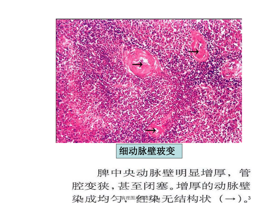 病理图片描述汇总培训课件.ppt_第3页