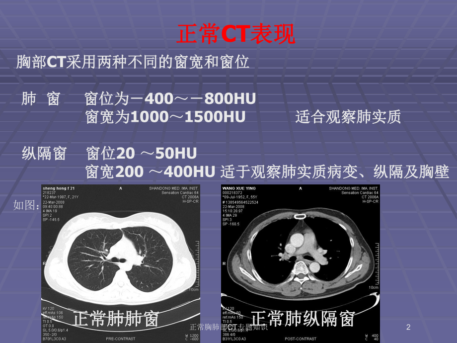 正常胸肺部CT专题知识培训课件.ppt_第2页