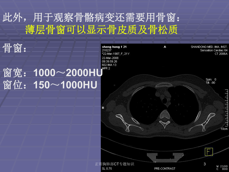 正常胸肺部CT专题知识培训课件.ppt_第3页