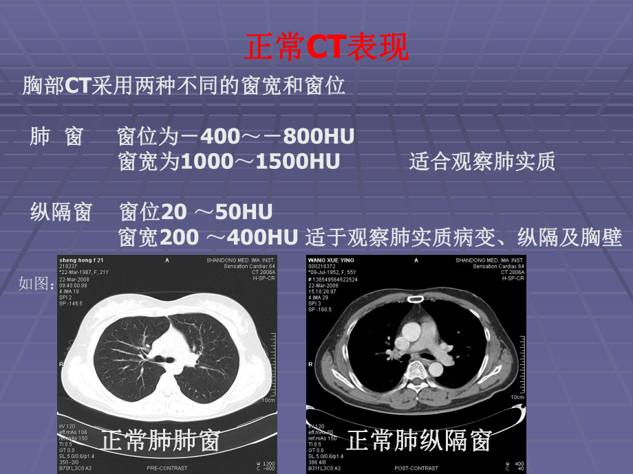 正常胸肺部CT影像学表现课件.pptx_第2页