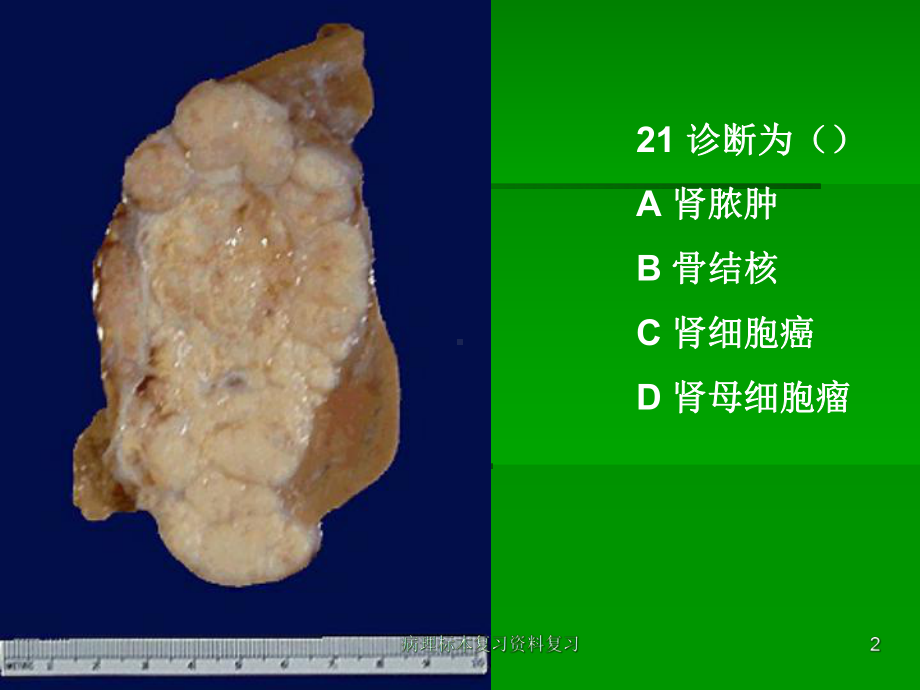 病理标本复习复习课件.ppt_第2页