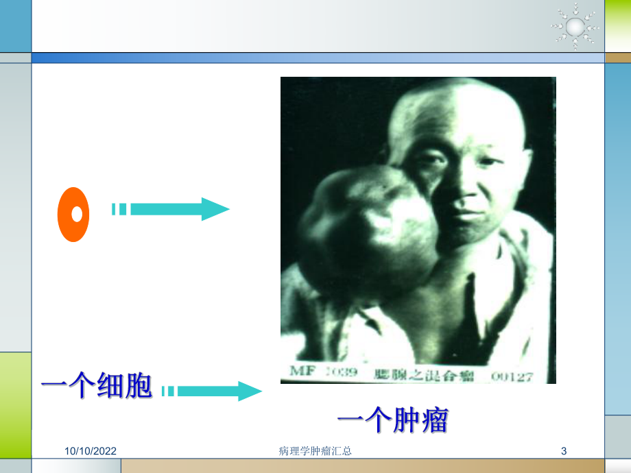 病理学肿瘤汇总培训课件.ppt_第3页