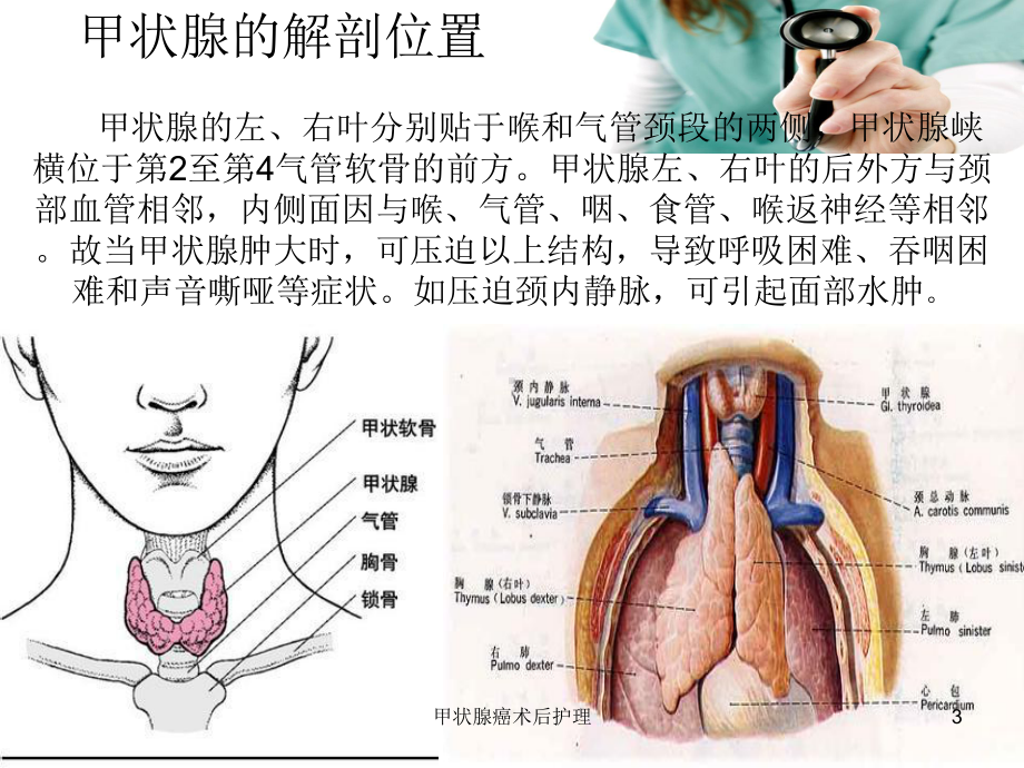 甲状腺癌术后护理培训课件.ppt_第3页