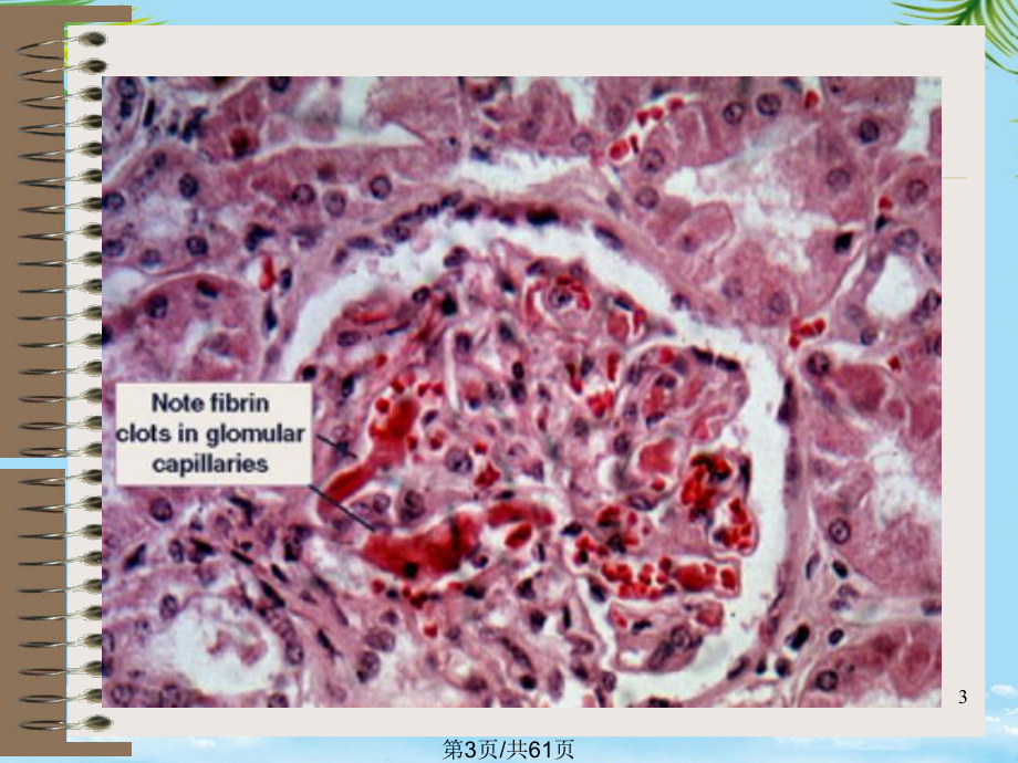 病理生理全面版课件.pptx_第3页