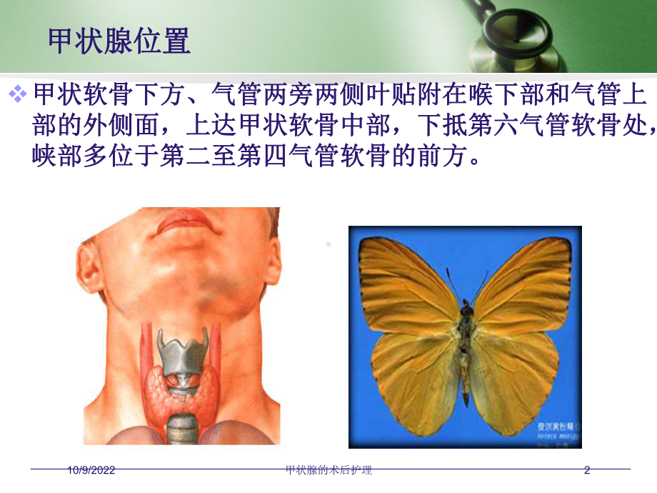 甲状腺的术后护理培训课件.ppt_第2页