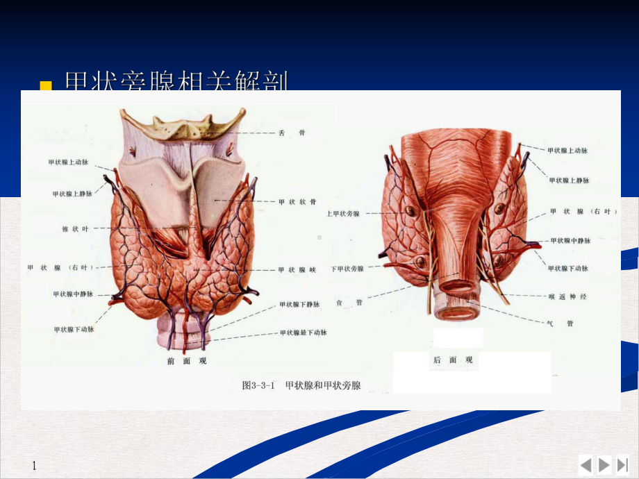 甲状旁腺功能亢进症配手术实例图课件.pptx_第3页