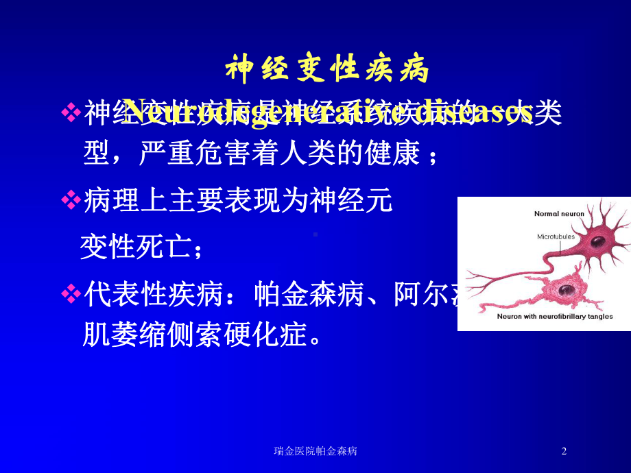 瑞金医院帕金森病培训课件.ppt_第2页