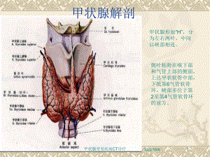 甲状腺常见疾病CT诊疗培训课件.ppt