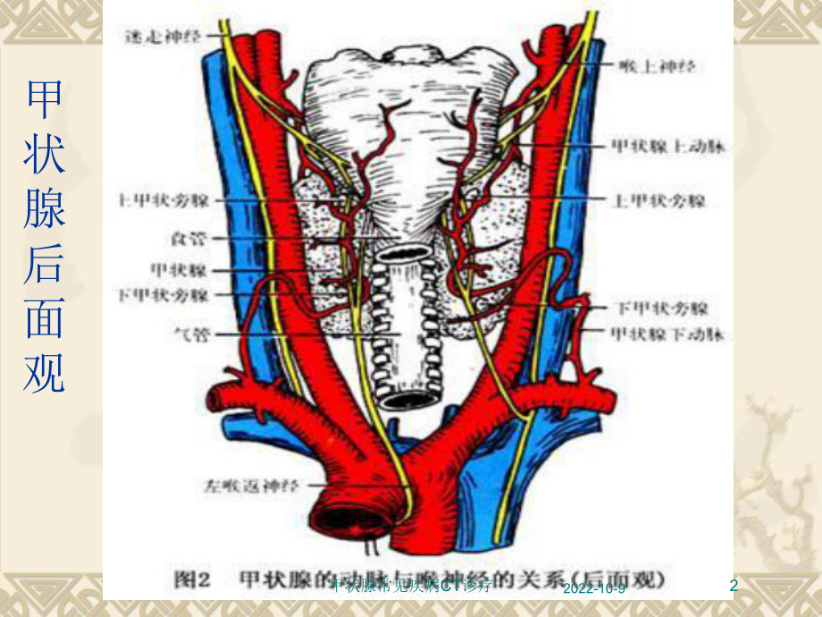 甲状腺常见疾病CT诊疗培训课件.ppt_第2页