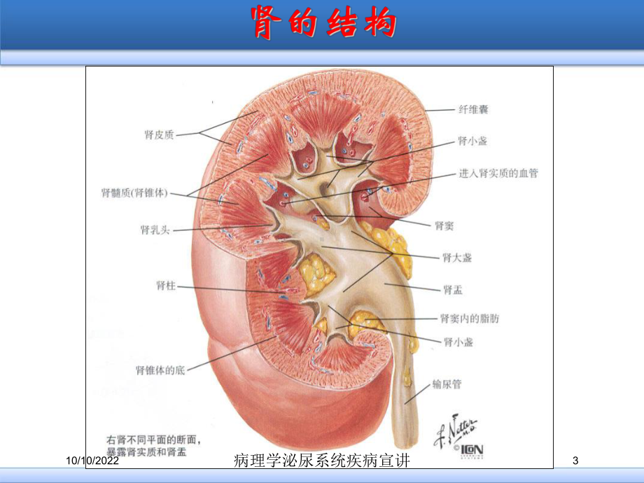 病理学泌尿系统疾病宣讲培训课件.ppt_第3页