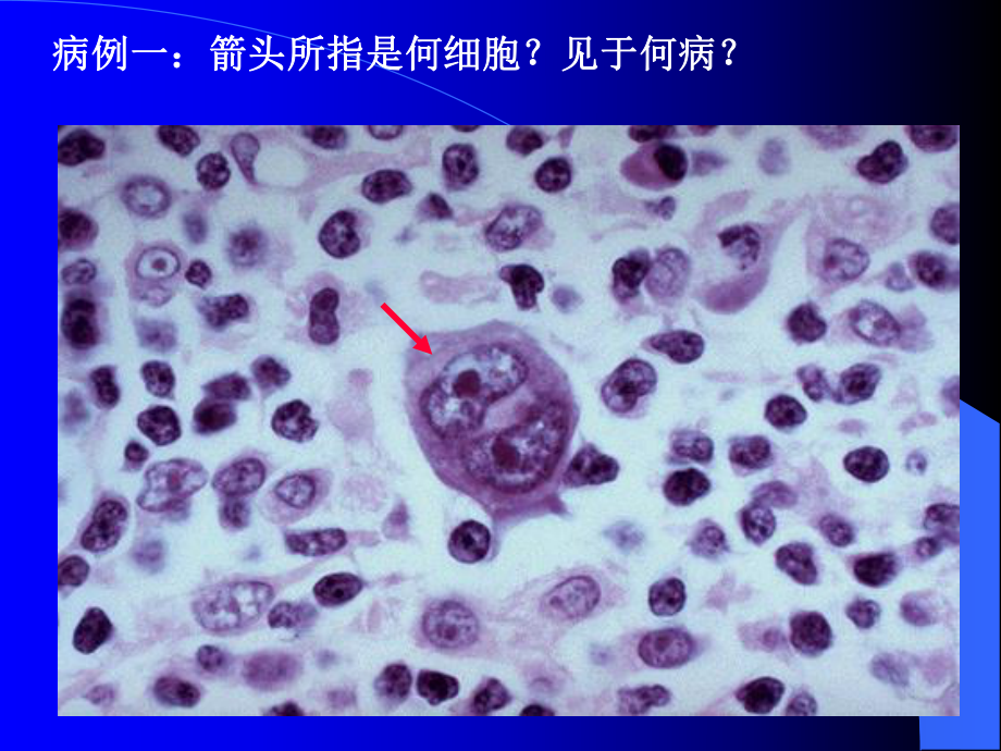 病理实验模拟考：病理解剖学实验模拟A课件.ppt_第2页