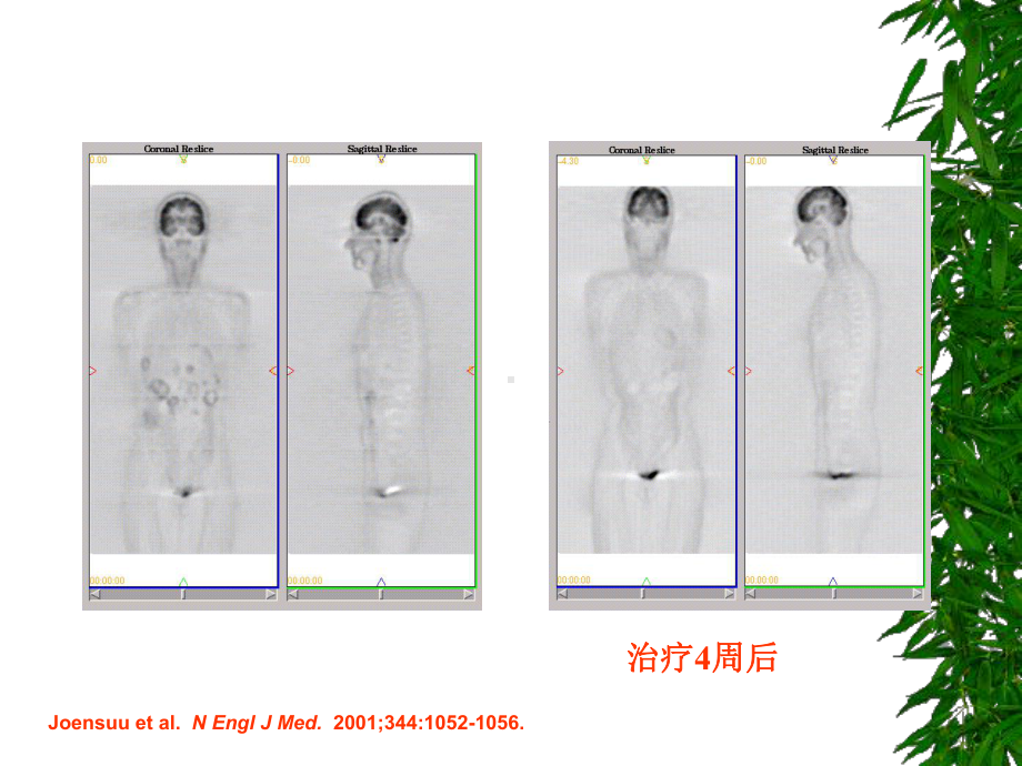 病理学与病理生理学No课件.pptx_第3页