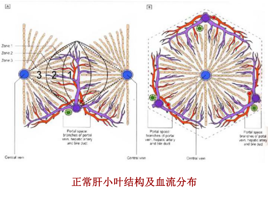 病理学课件病毒性肝炎.ppt_第2页