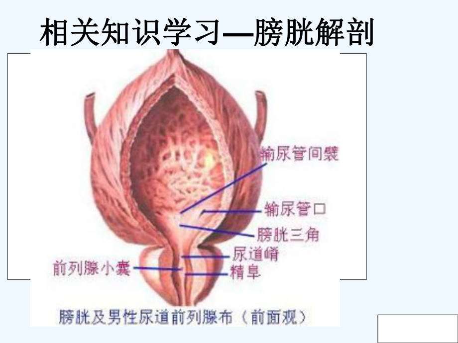 泌尿外科护理查房-课件.ppt_第3页