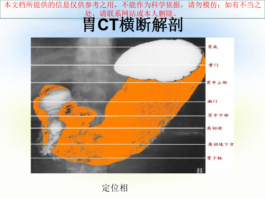 正常腹部CT解剖培训课件.ppt_第2页