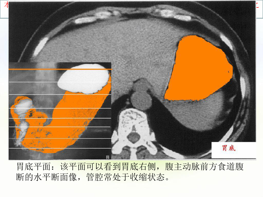 正常腹部CT解剖培训课件.ppt_第3页