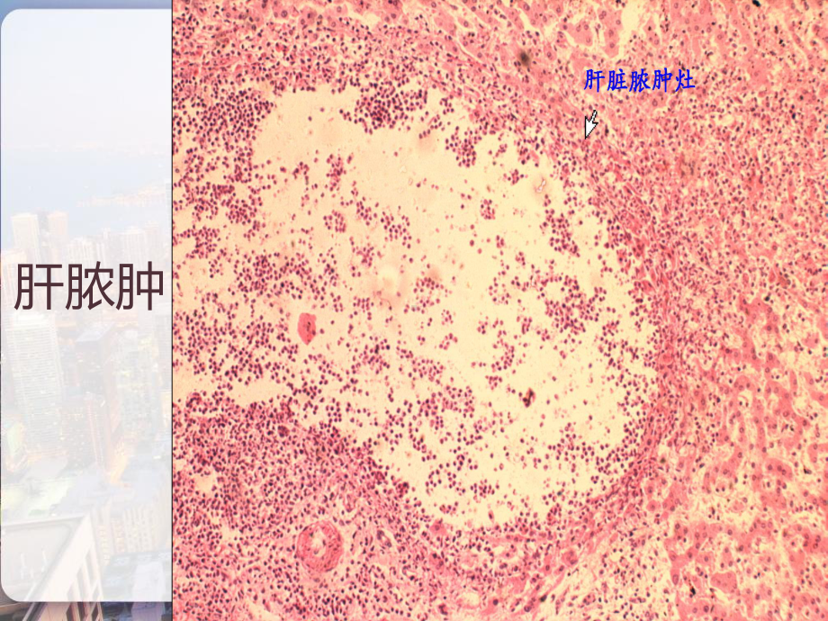 病理切片考试最完整版-课件.pptx_第3页