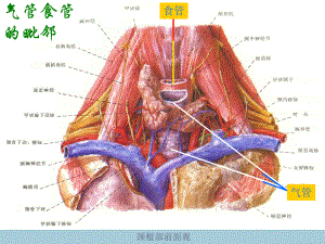 气管食管培训课件.pptx