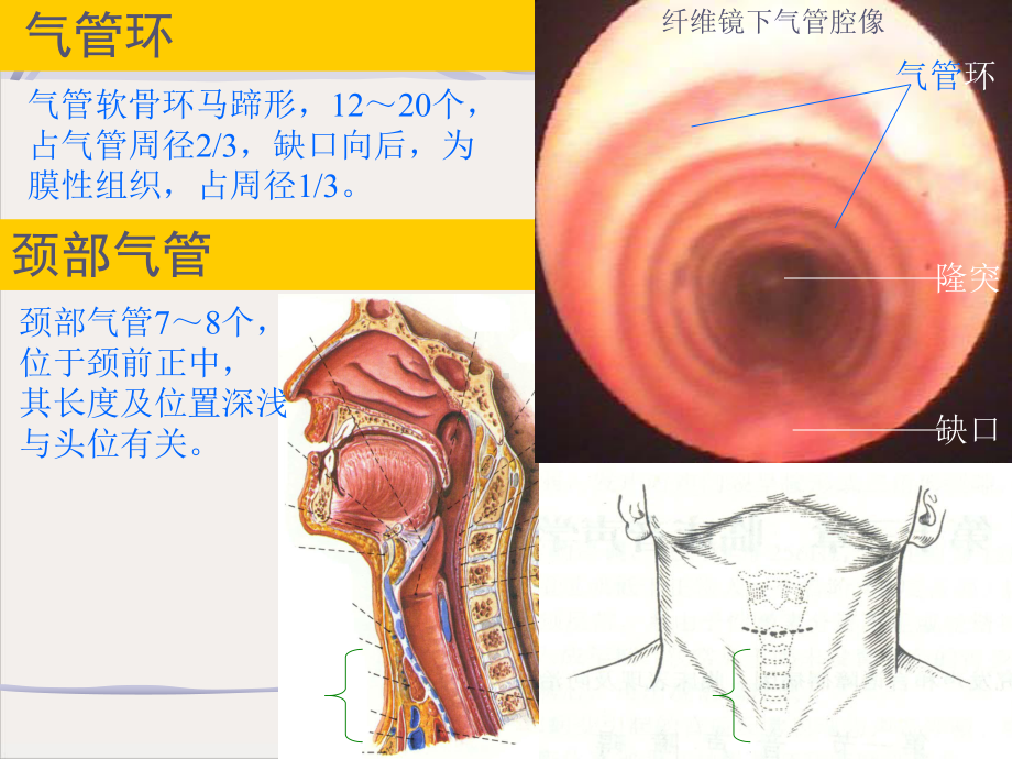 气管食管培训课件.pptx_第3页