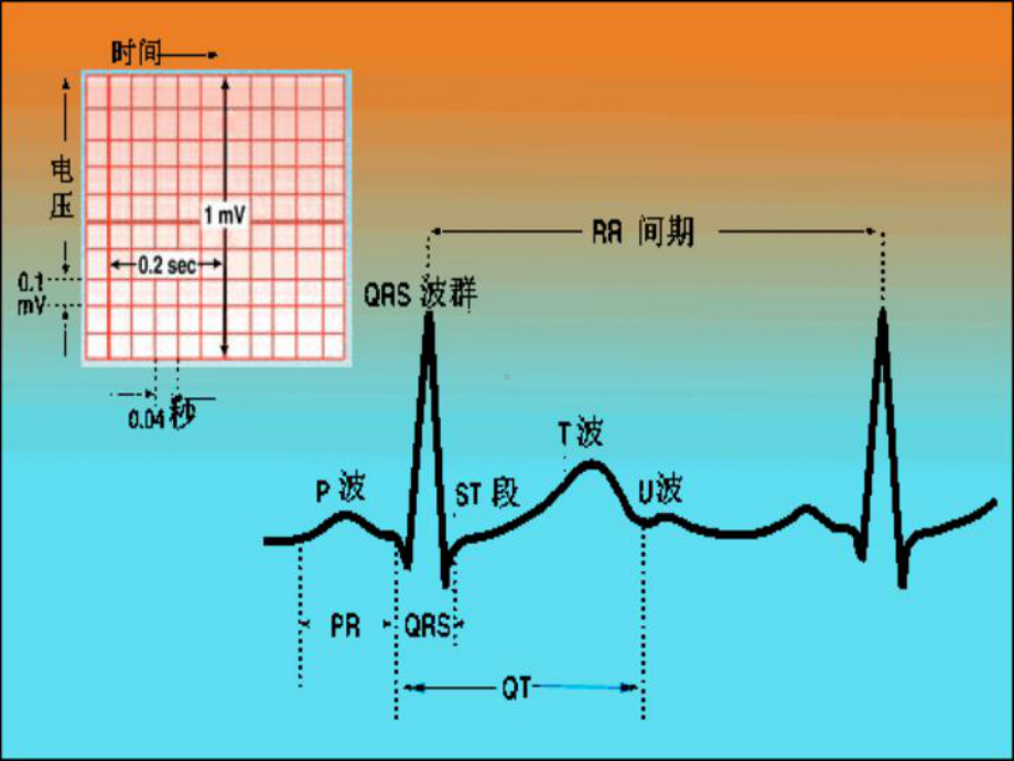 正常心电图和常见异常心电图的识别和处置培训课件.ppt_第2页