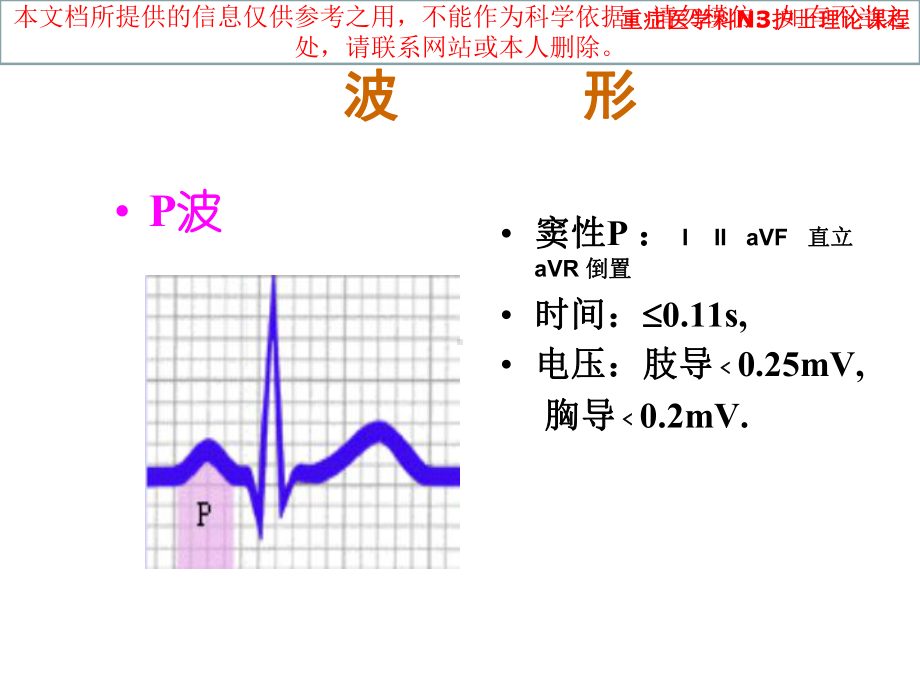 正常心电图和常见异常心电图的识别和处置培训课件.ppt_第3页