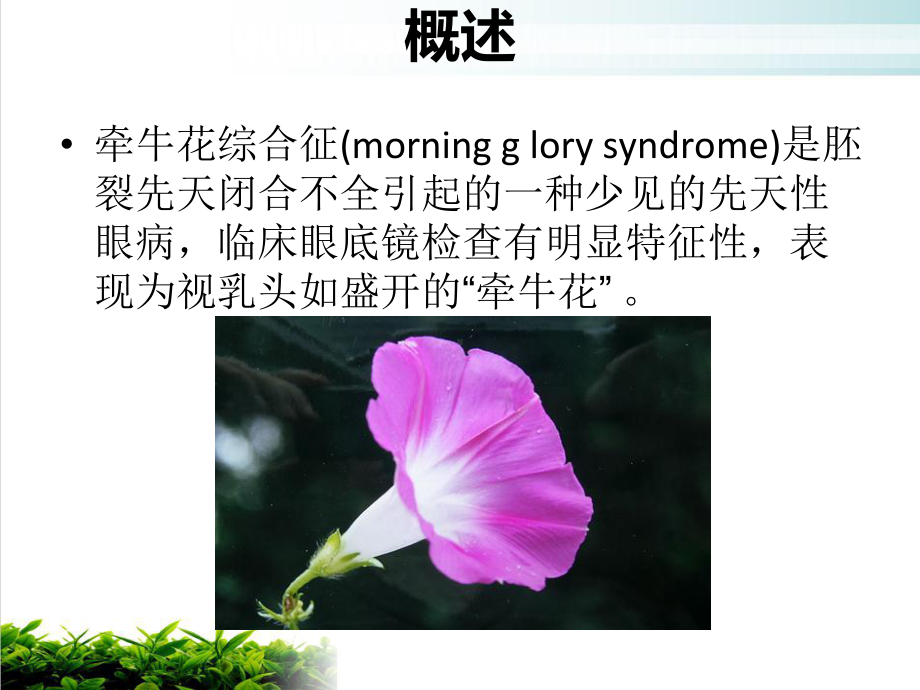 牵牛花综合征的影像学表现课件-2.ppt_第3页